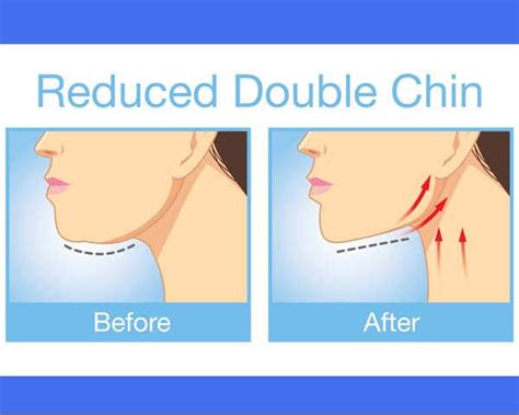 8 Workouts To Lose Chubby Cheeks And Get A Defined Face - Home Remedico