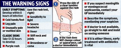 Meningitis: Baby with purple rash dies after he is sent home from out-of-hours clinic with ...