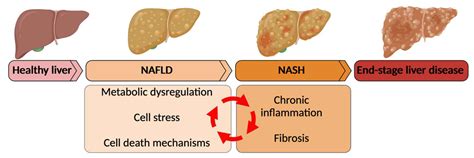 Fatty Liver Fibrosis | Hot Sex Picture