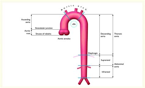 Segments of the ascending and descending aorta. rPA = right pulmonary ...