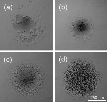 Mycoplasma Pneumoniae Colonies