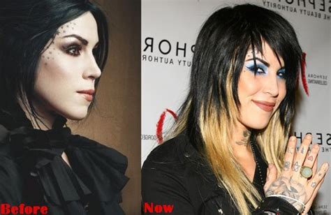 Kat Von D Plastic Surgery Before And After Photos