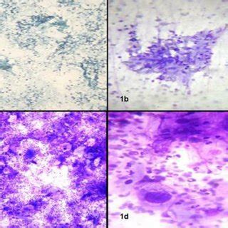 (PDF) SPECTRUM OF FNAC IN PALPABLE HEAD AND NECK LESIONS IN A TERTIARY ...