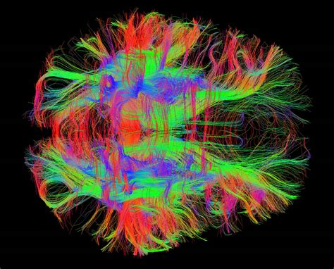 Visualizing the Brain - MIT McGovern Institute