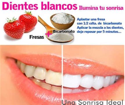 Limpieza Dental Profunda Casera