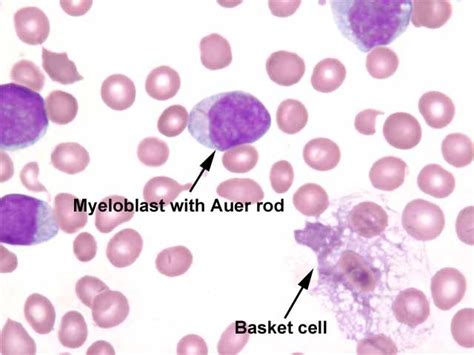 Lecture Notes in Medical Technology: Lecture #9 : The White Blood Cells