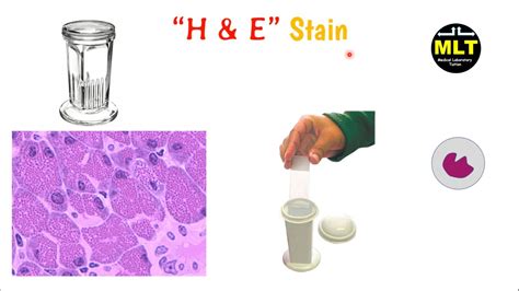 H&E Staining Protocol / Oil Red O And Hematoxylin And Eosin Staining ...