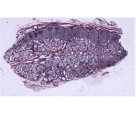 Loose Connective Tissue Reticular