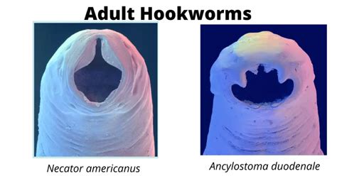 Hookworm: Characteristics, Life Cycle, Pathogenesis and Diagnosis ...