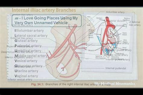 My Medical Mnemonics - Branches of Internal Iliac Artery : My Medical ...