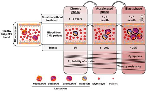 Progression of chronic myeloid leukemia. Chronic myeloid leukemia (CML)... | Download Scientific ...