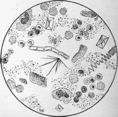 Microscopical Examination of the Faeces. Part 3