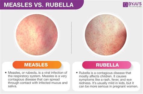 WHO South-East Asia Region plans to banish measles, rubella by 2023 ...