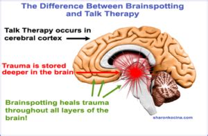 Brainspotting – radcliffecounseling