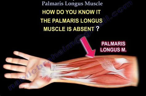 Anatomy of #Palmaris Longus — OrthopaedicPrinciples.com