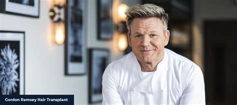 Chef Gordon Ramsay Hair Transplant - Smile Hair Clinic