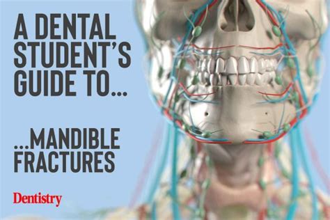 A Dental Student’s Guide to…mandible fractures - Dentistry