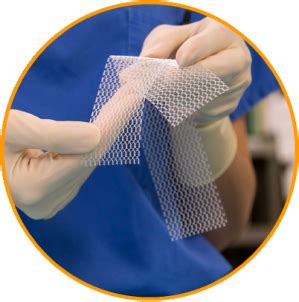 Polypropylene Mesh – MEDICSHELF