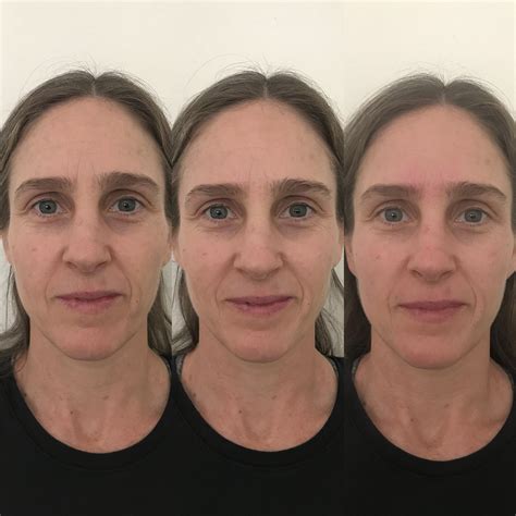 NuFace Results on Different Faces — The Organic Esthetician