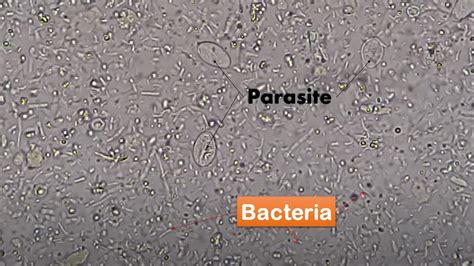 Bacteria and Parasites in stool Microscopy/ Live motile bacteria and ...