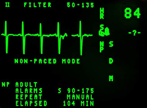 ECG Free Stock Photo - Public Domain Pictures