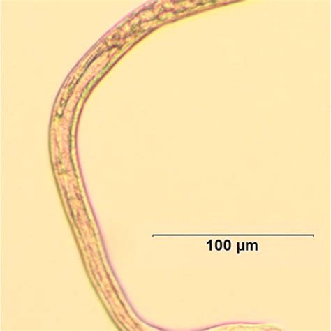 Toxocara cati eggs in fecal smear of pet cats | Download Scientific Diagram