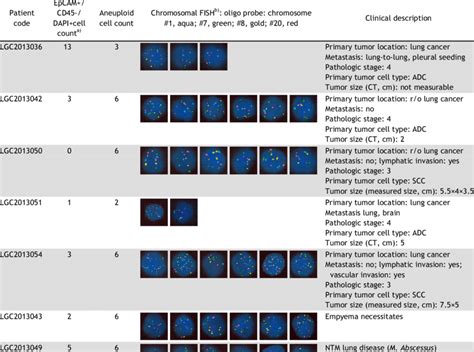 Detection of aneuploid cells in the blood of patients with lung diseases | Download Table