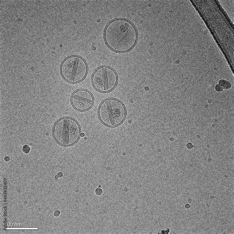 Nanoparticles made of lipids (liposomes) containing an anticancer drug ...