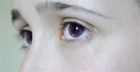 A Collection Of People With Purple Eyes And What Causes Them - Conscious Reminder