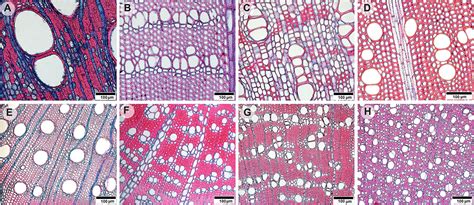 Frontiers | Parenchyma Abundance in Wood of Evergreen Trees Varies ...