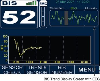 86: Bispectral Index Monitoring | Clinical Gate