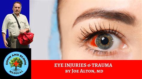 Eye Injuries and Trauma: First Aid and Treatments - YouTube