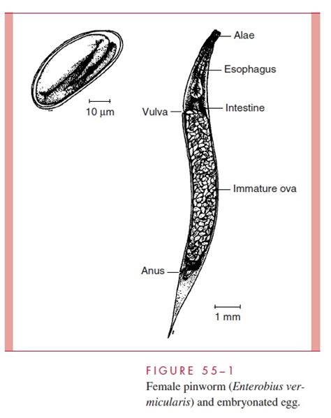 Enterobius Vermicularis Ova