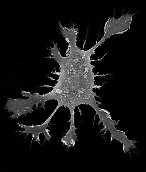 Dendritic Cell Electron Microscope