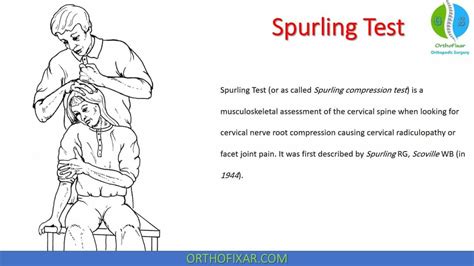 Spurling Test : r/orthofixar