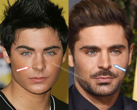 Zac Efron, Before and After 2020