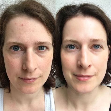 So I started a genuine skincare regimen and this is what happened ...