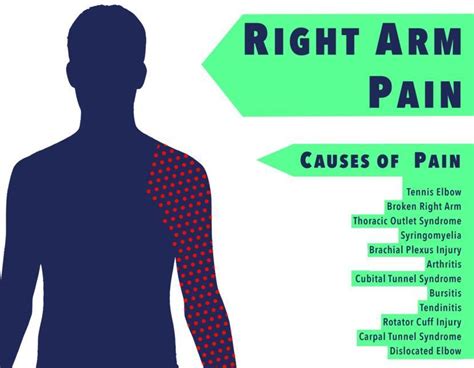 Pain in the Right Arm: Causes and Home Remedies (2024)