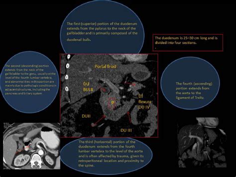 Imaging Anatomy of Hepatoduodenal Ligament: Revisited | Semantic Scholar