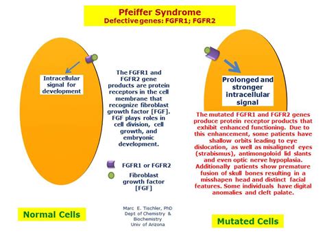 Pfeiffer Syndrome | Hereditary Ocular Diseases