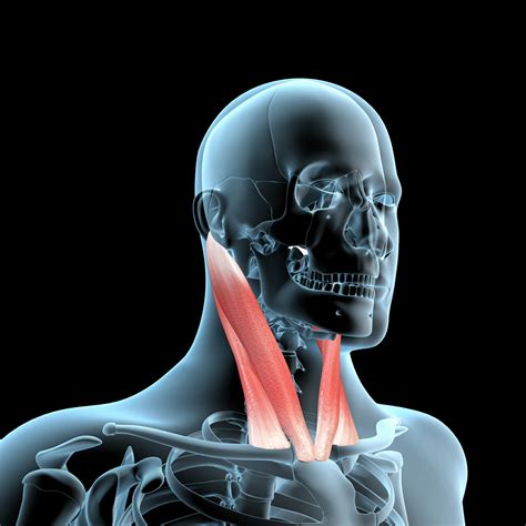 Sternocleidomastoid Muscle May Be Used Excessively in PAH