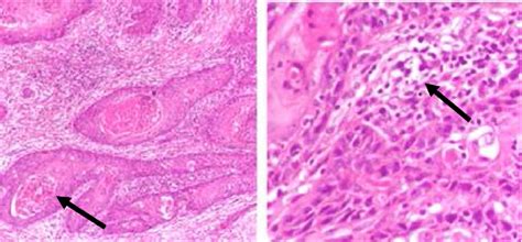 Right buccal mucosa histology. | Download Scientific Diagram