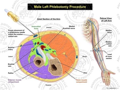 Male Left Phlebotomy Procedure