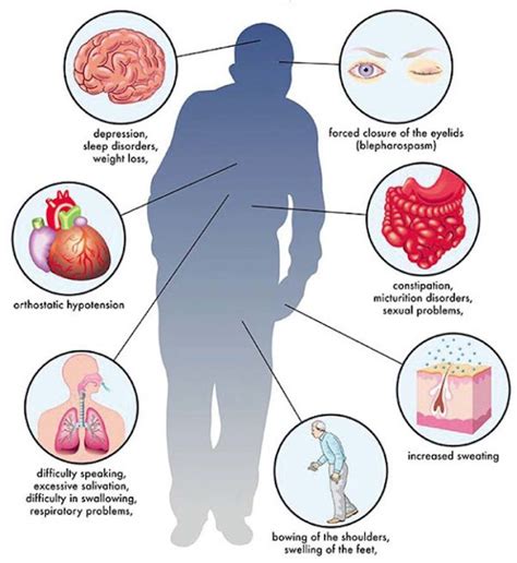 Our Parkinson's Place: Understanding Parkinson’s Disease