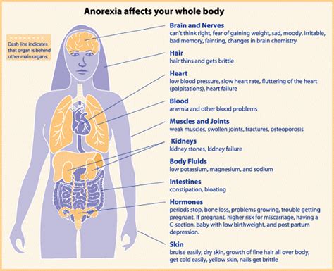 Anorexia Nervosa Causes