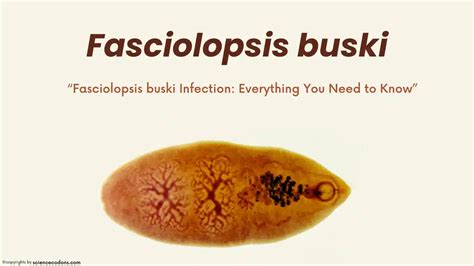 Fasciolopsis buski: A Guide to the Giant Intestinal Flukeworm Infection ...