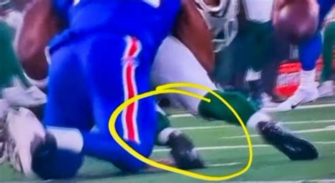 Gruesome Slo-Mo Video Shows Close-Up Of Aaron Rodgers’ Injury