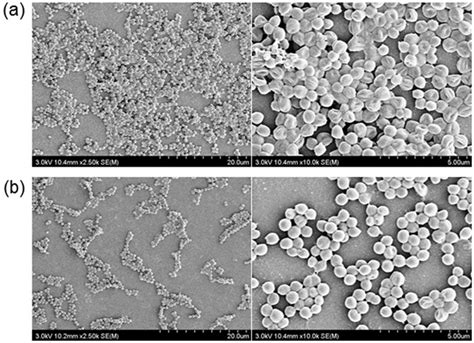 Spontaneous detachment of Streptococcus mutans biofilm by synergistic effect between zwitterion ...