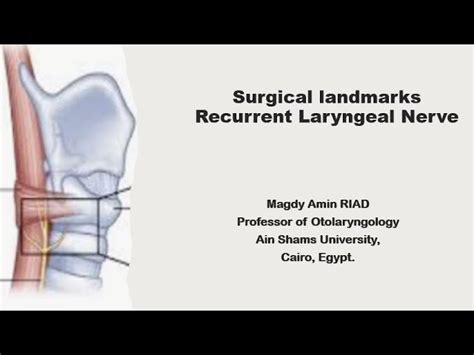 Recurrent Laryngeal Nerve In Thyroidectomy