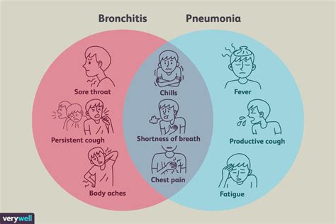 Bronchitis vs. Pneumonia: Similarities and Differences